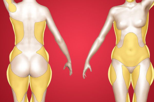 Мне нужно было узнать об этом еще год назад! Как удержать вес после похудения.