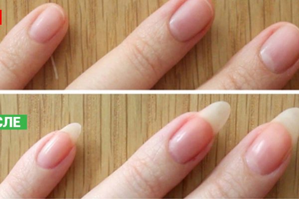 Всего 3 ингредиента подарят твоим ногтям красоту и здоровье! Результат молниеносный.