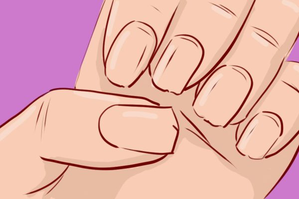 Вот о чём говорят слишком хрупкие и ломкие ногти! Не просто косметический недостаток…