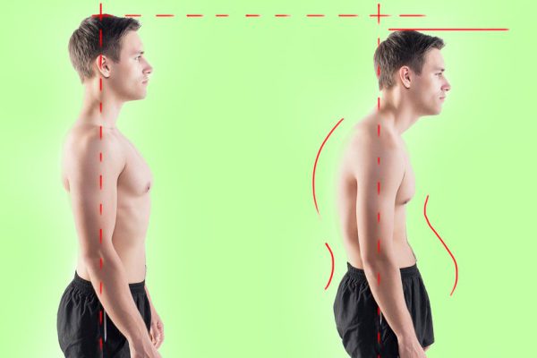 4 простых шага на пути к идеальной осанке.