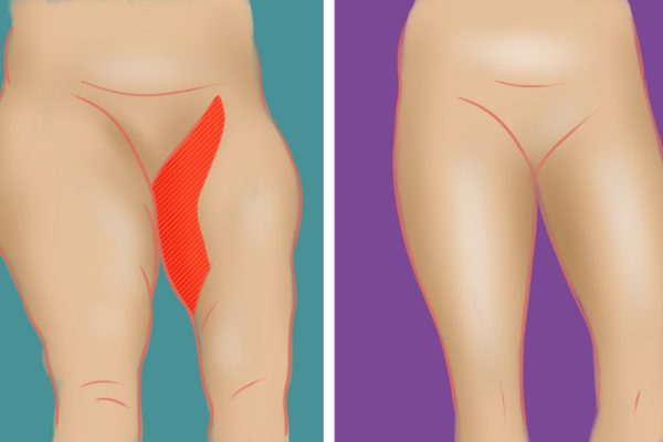 Тело стало нелегким! Брату секрет стоит узнать…