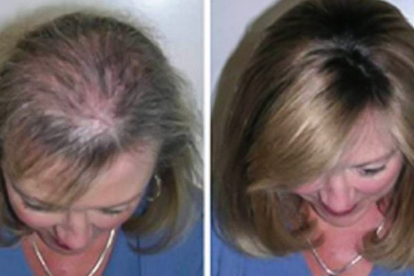 Быстрый рост волос благодаря этому трюку! Через месяц я не поверила своим глазам…