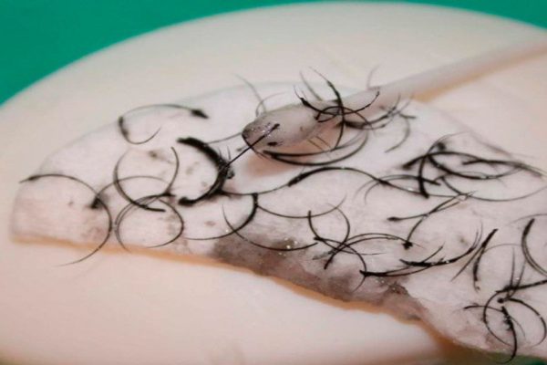 Жертва наращивания ресниц: ужасные последствия! Стоит отказаться от этой процедуры немедленно…