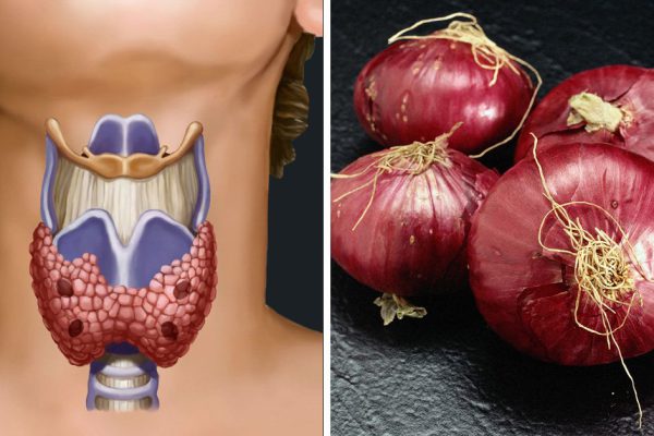 Он поставил луковый компресс на шею. То, что произошло через несколько часов, — поразительно!