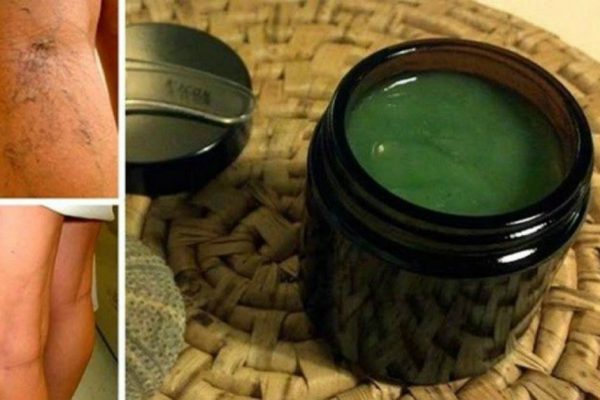 Средство от варикоза по бабушкиному рецепту: первые результаты заметны почти сразу!