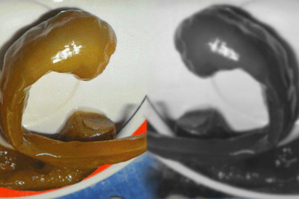 Спасайте печень! Чтобы печень случайно не отказала…