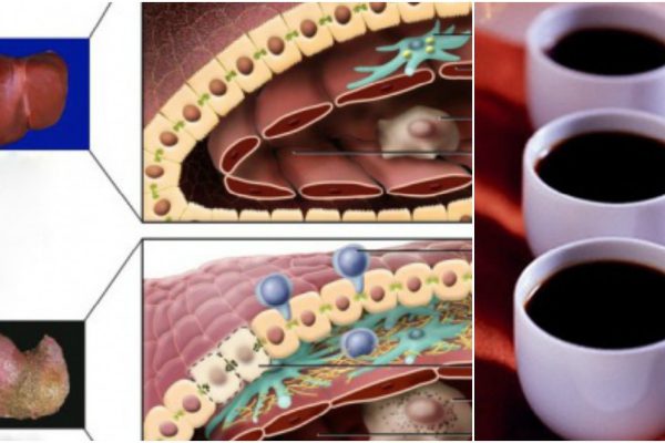 Вот что сделают три чашки кофе с печенью и другими органами!