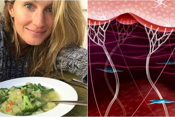 Антивозрастная диета для стимуляции выработки коллагена. Продукты на страже красоты и молодости.