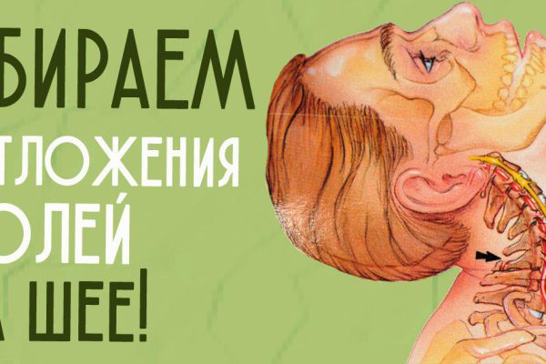 Вот как «разбить соли» в области шеи! Всю серьезность осознаю и следую…