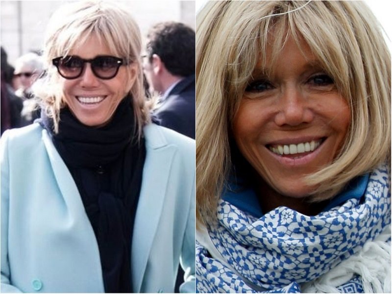 короткая шея