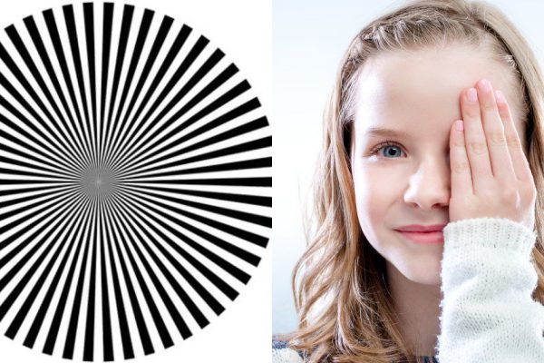 Признаки астигматизма