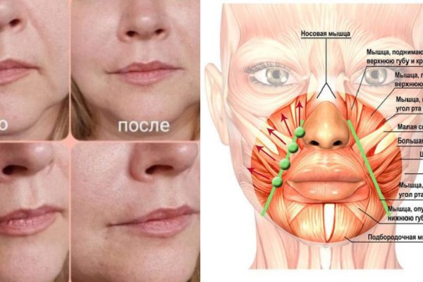 Заметила, что кожа вокруг губ стала обвисать? Немедленно сотри «складки скорби» с лица!