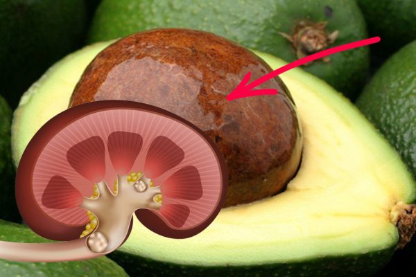 Всего 1 косточка, и почки свободны от камней! Старинный индийский рецепт.