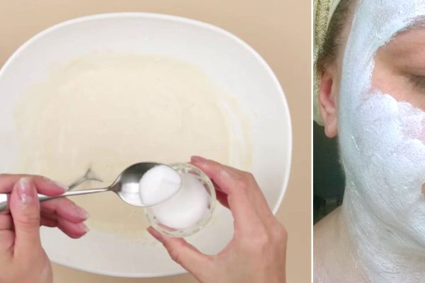 Крахмал вместо ботокса? Моя мама пользуется. Никто не знает, сколько ей лет на самом деле.