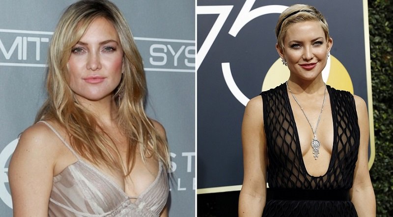 самые модные пластические операции