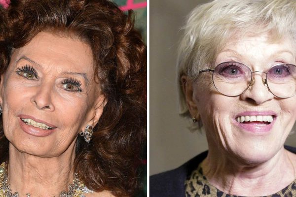 Звезды-сверстницы, одна из которых что-то сделала с лицом