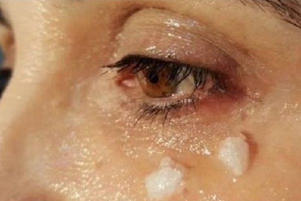 Что же будет через 5 минут, если нанести кокосовое масло на область вокруг глаз?