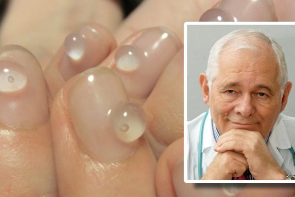 «Не стригите грибковые ногти, заклинаю! Грибок отлично выводится этим дешевым…»