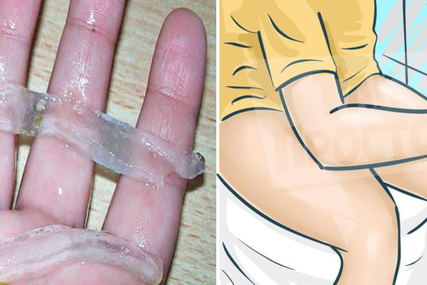 Средство, которое поможет избавиться от геморроя раз и навсегда!