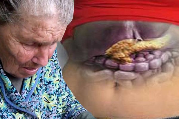 Вот как я вылечила поджелудочную железу. Хочу поделиться рецептом моей прабабушки.