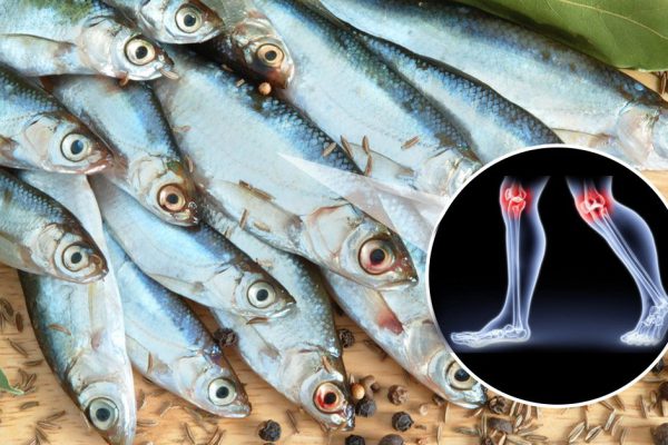 Первый шаг к избавлению от артрита: вычеркни из рациона опасные для суставов продукты