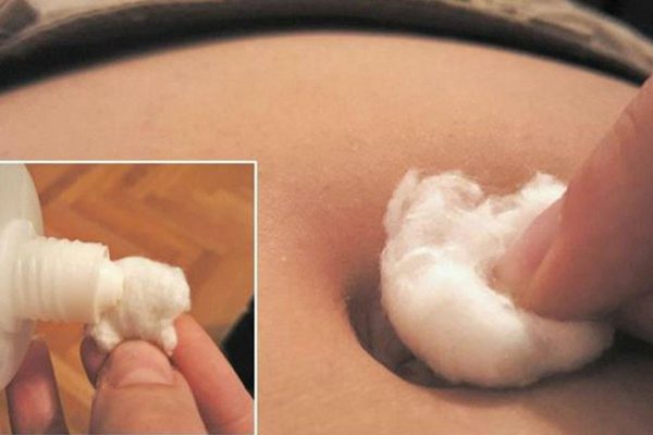 Требуется лишь засунуть ватку, смоченную в спирте, в пупок! Уйдет кашель, простуда, менструальные боли…