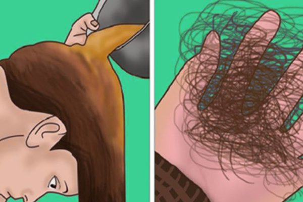 Три теста при выпадении волос. Надо узнать причины медленного облысения.