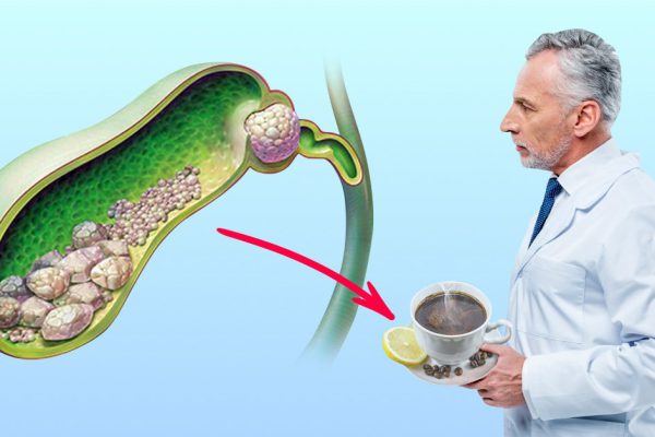 Тушари Джалаят: «Разрешаю пить кофе! Кроме того, есть еще 4 рецепта для желчного…»