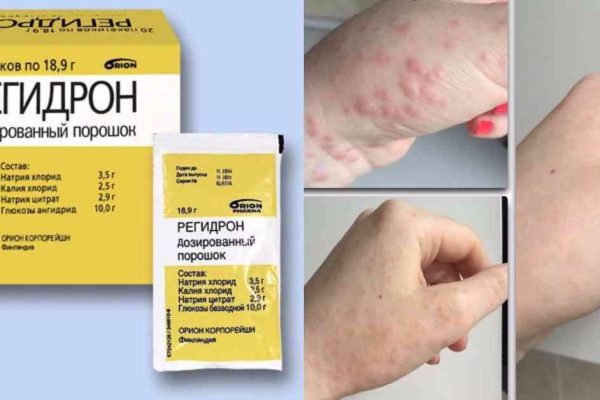 Больше не покупаю «Регидрон»! Причина фантастическая…