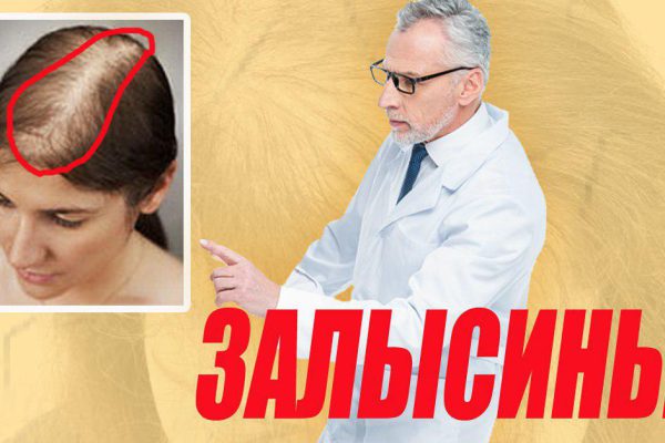 Залысины? Врач показал домашний способ, как сделать волосы густыми за 7 дней!
