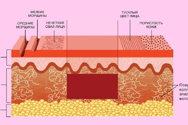 Эта маска проникает в глубокие слои дермы, тем самым избавляет от многих проблем! Находка!