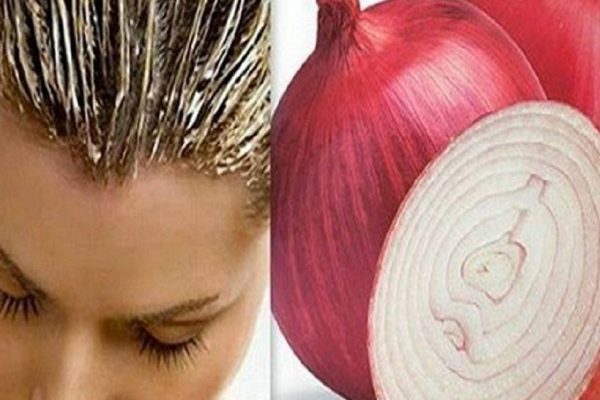 Лучшая маска против выпадения волос! Когда оживают волосяные луковицы…