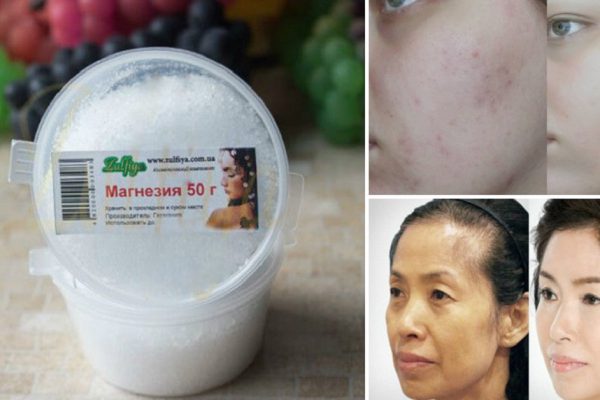 6 способов применения магнезии, о которых нужно было знать еще вчера!