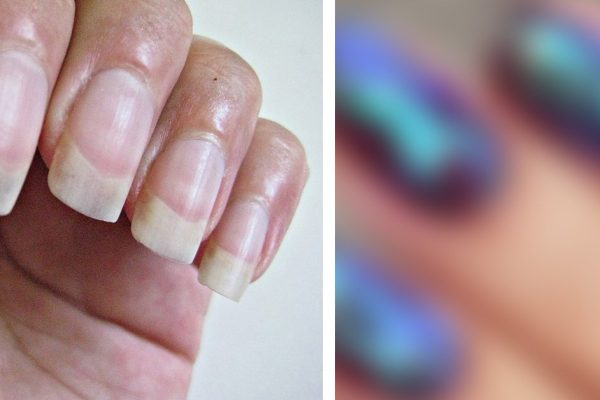 Маникюр, который преобразит даже самые убитые ногти: легко, стильно и красиво!