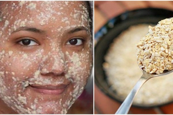 Больше никаких темных пятен: эта маска избавит тебя от проблем с кожей всего за 30 минут!