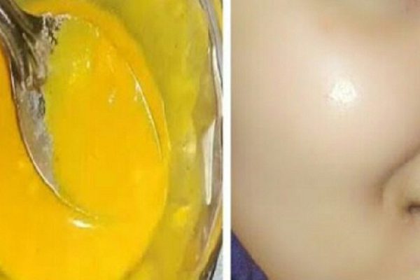 Моя мама вновь выглядит моложе, используя этот великолепный рецепт! Как следует промажь…