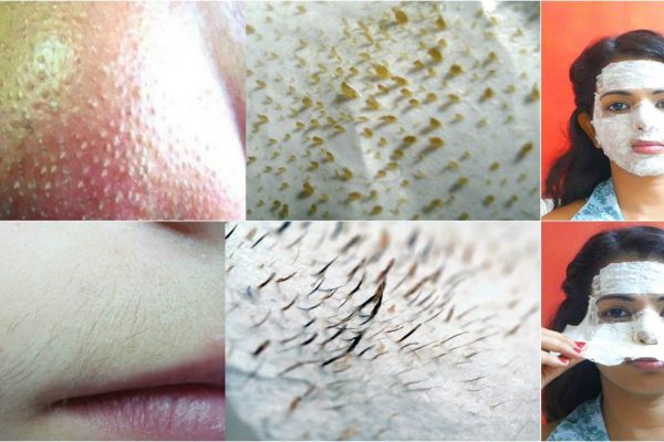 Чудо-маска с легкостью уберет ненавистные черные точки! И даже усики ей под силу.