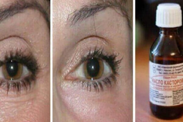 5 лучших масел от морщин! Морщины буквально «уползают»…