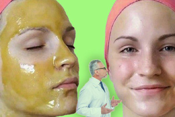 «Гусиные лапки» у глаз? Чтобы омолодить кожу лица на 15 — 20 лет, в срочном порядке…