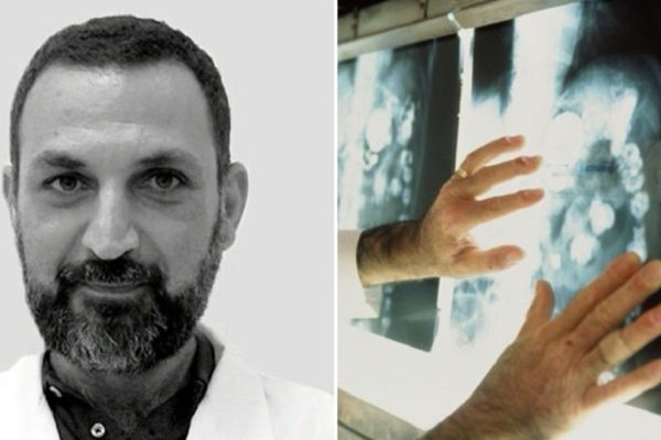 Именитый онколог рассказывает: «Потом хирург-гинеколог решил потренировать руки — и удалил еще и яичники. Но рак в результате…»