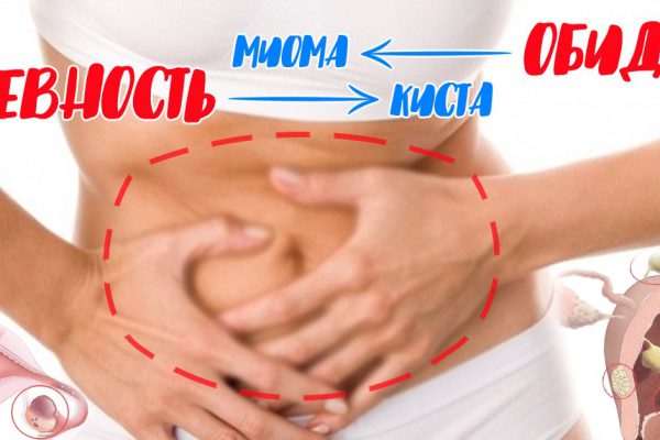 Психосоматика — вещь неумолимая, все женские болезни от обид на мужиков!