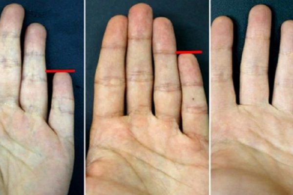 Вот о чём могут рассказать мизинцы на твоих руках! Узнал кое-что неожиданное…