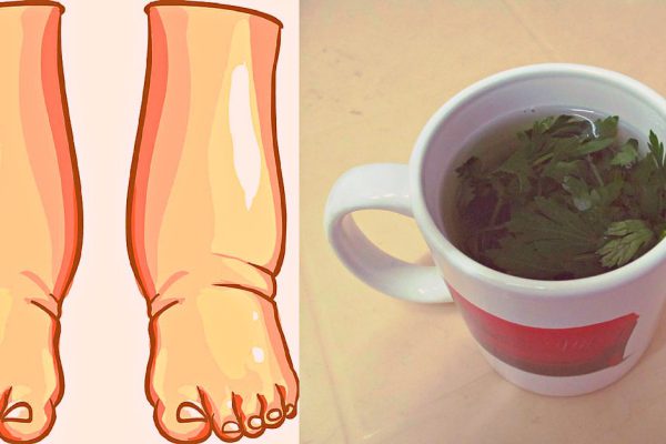 Это, пожалуй, самое мощное натуральное средство при отечности ног!