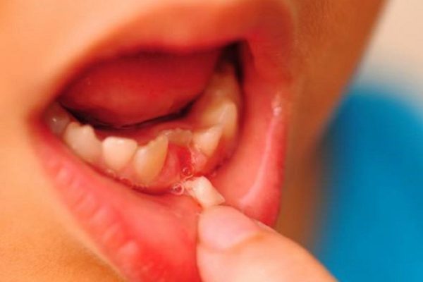 Вот почему не нужно отдавать молочные зубы зубной фее. Поразительное открытие!