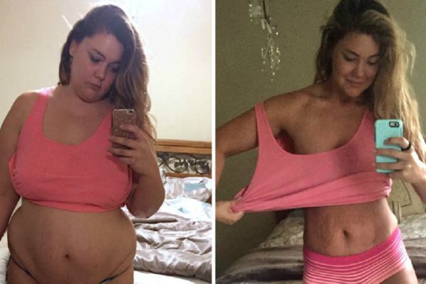 Эта женщина весила 141 кг, а через год — уже 57 кг. Вот как ей это удалось!
