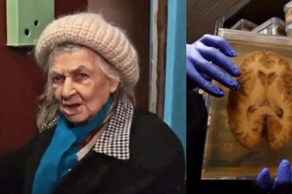 Синдром Диогена — болезнь, которая атакует стариков! Это вовсе не старческая причуда…