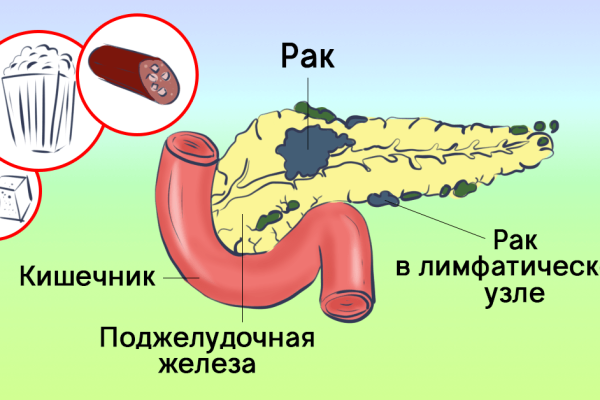 Онкологам уже неудобно напоминать об этом! «Если вы не прекратите употребление этих продуктов, раковая опухоль…»