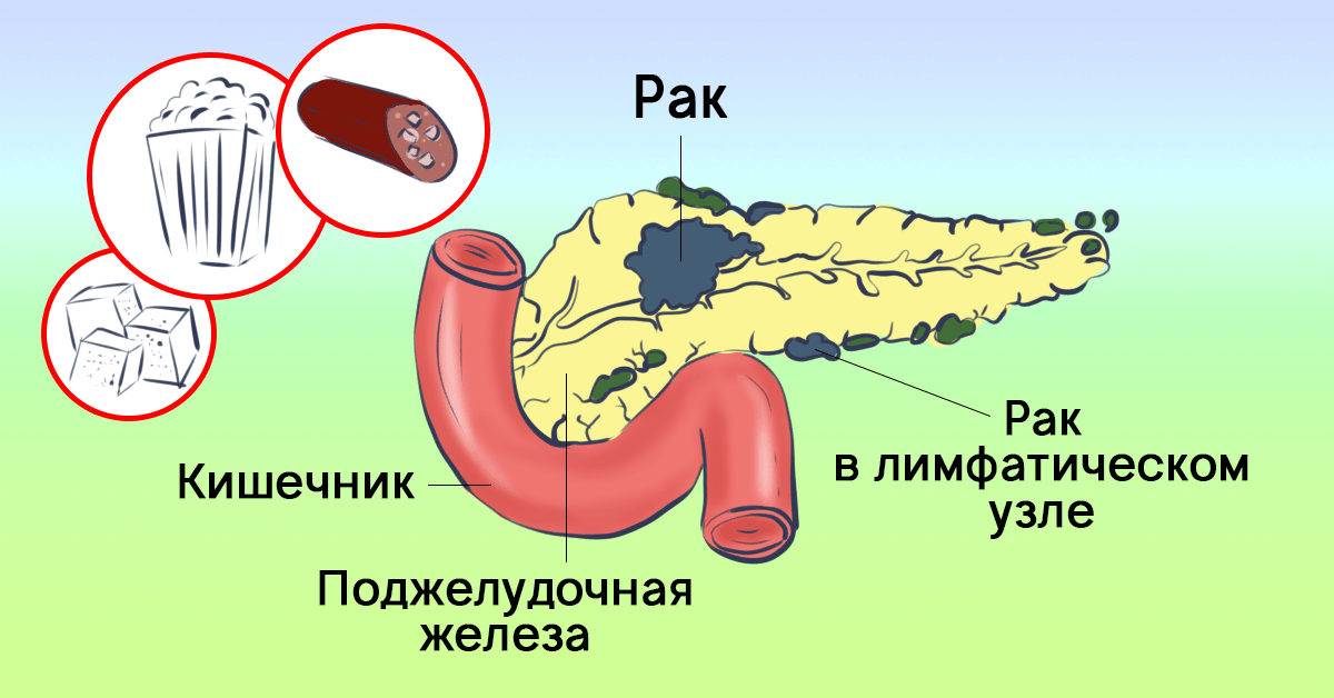 Чистка печени по морицу схема и описание