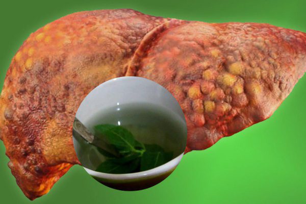 «Мохнатую» от перегрузки и ожирения печень реанимирует стакан этого напитка, возьми 3 ст. л…