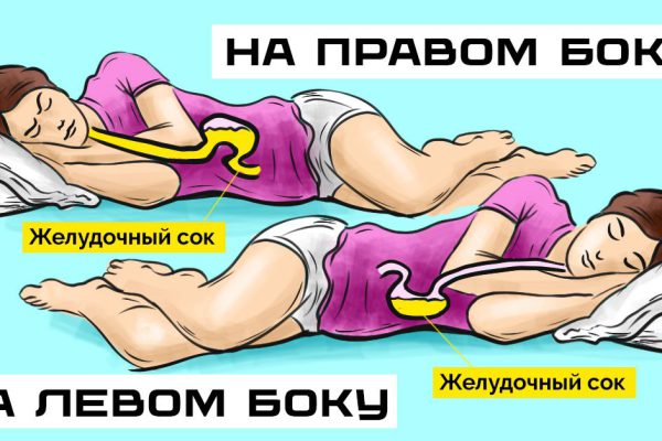 Лечащий приказал спать только на левом боку, самочувствие сразу же улучшилось